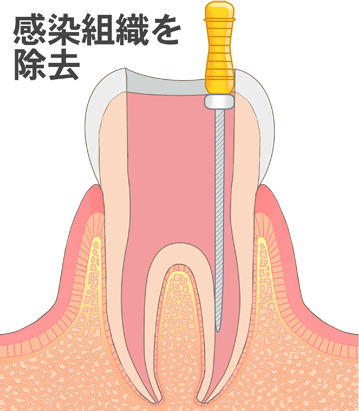 batsuzui