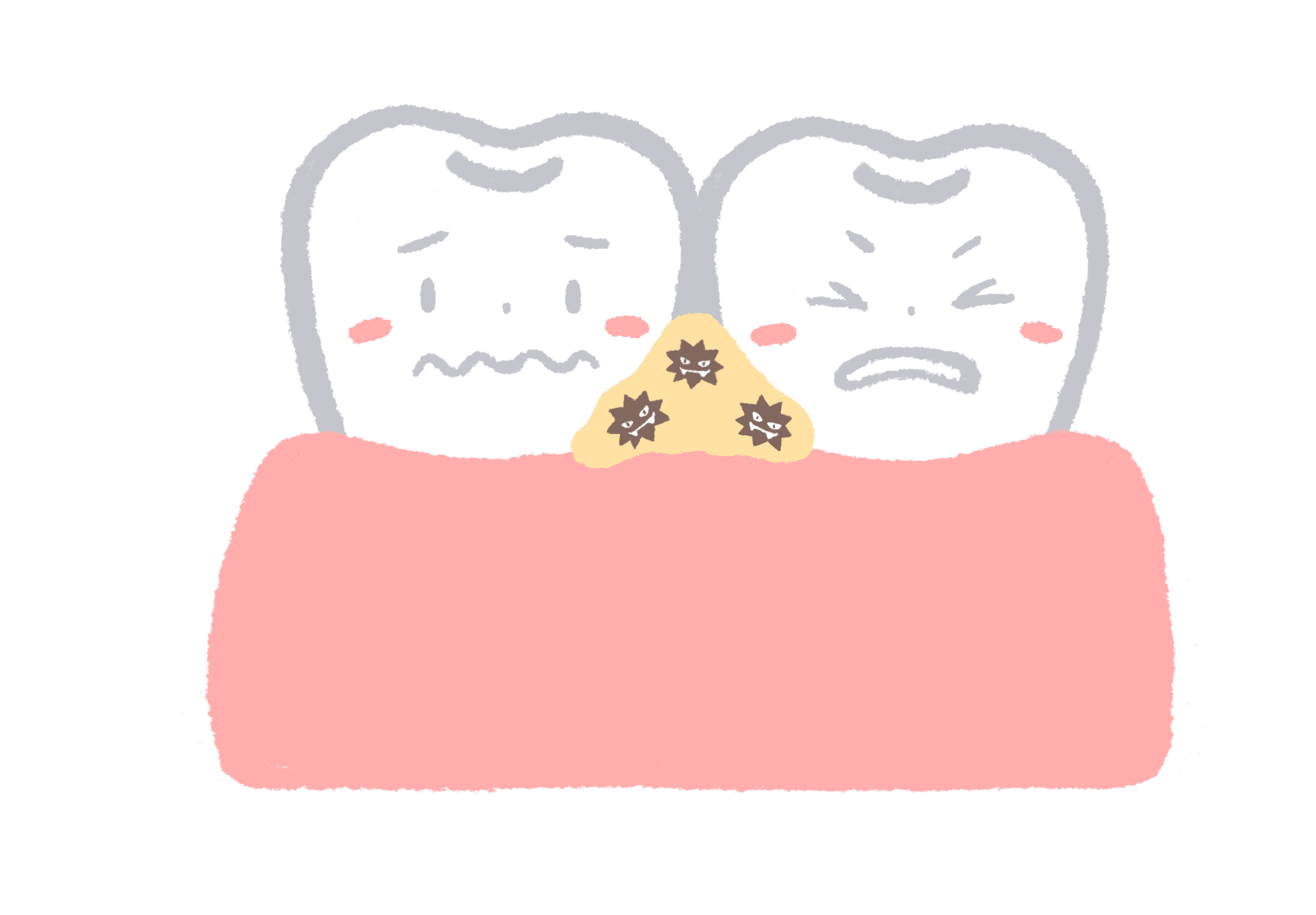 物が挟まった歯