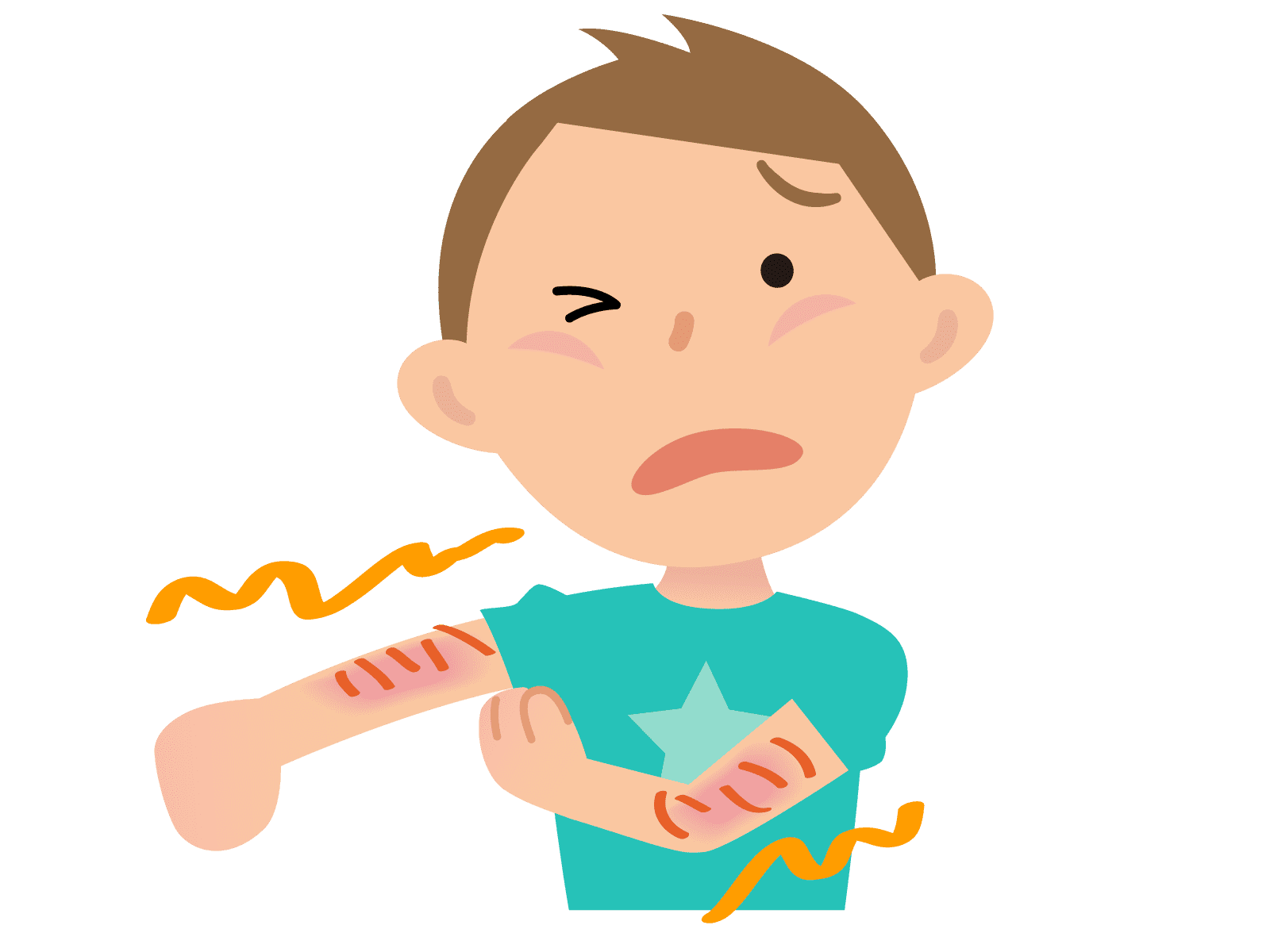 アレルギー症状を発症した様子