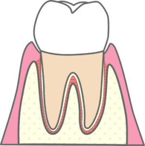 天然歯のイメージ